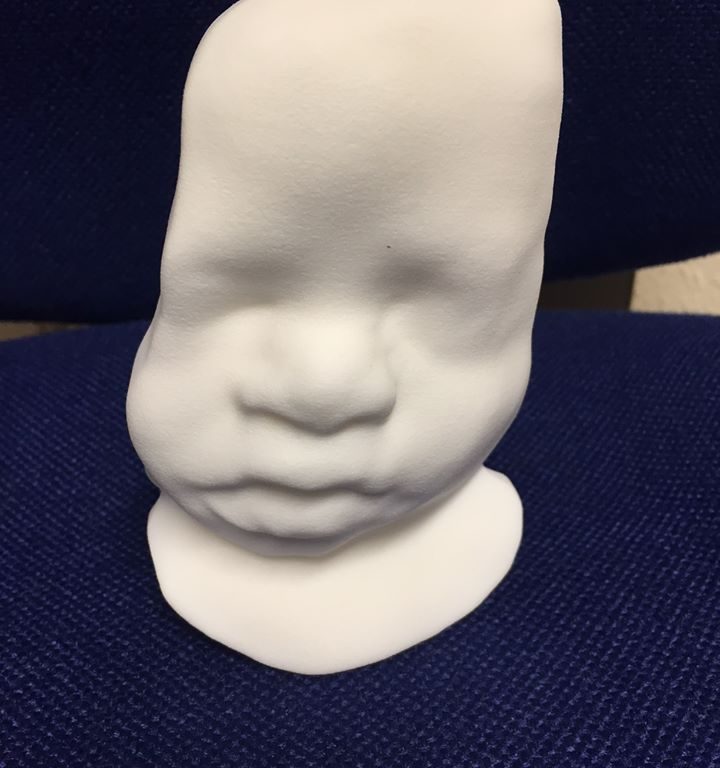 3D Printing a Foetus
