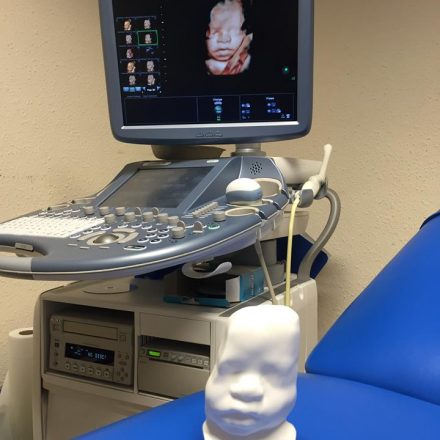 3D Printing a Foetus